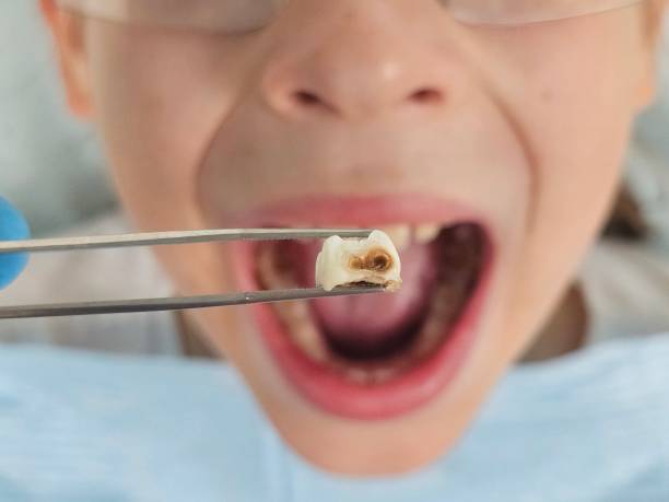 Best Emergency Denture Repair in Andover, MN